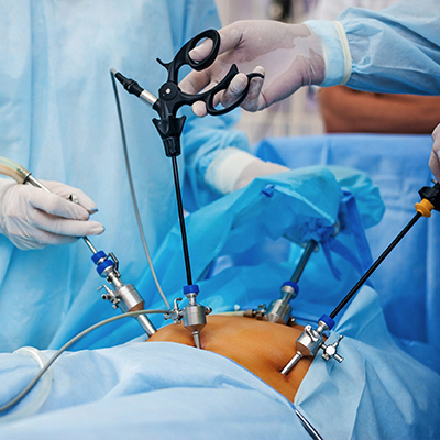 Shock Wave Lithotripsy